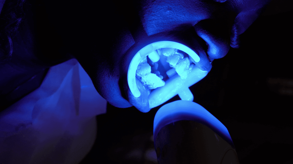 Teeth Whitening antalya Turkey